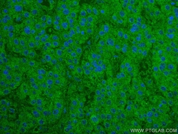 NCAPH Mouse Monoclonal Antibody, Proteintech Unconjugated; 20 &mu;L:Antibodies,
