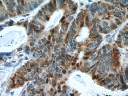 NCAPH Mouse Monoclonal Antibody, Proteintech Unconjugated; 20 &mu;L:Antibodies,