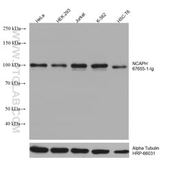 NCAPH Mouse Monoclonal Antibody, Proteintech Unconjugated; 20 &mu;L:Antibodies,
