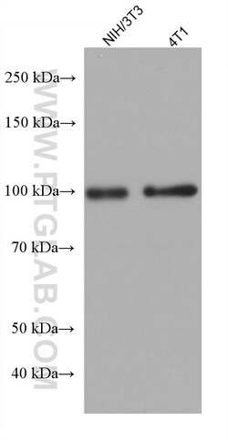 NCAPH Mouse Monoclonal Antibody, Proteintech Unconjugated; 20 &mu;L:Antibodies,