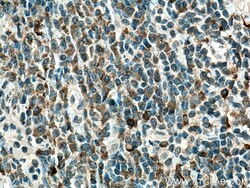 NOXA2/p67phox Mouse Monoclonal Antibody, Proteintech Unconjugated; 150