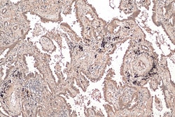 NCOA3 Rabbit Polyclonal Antibody, Proteintech Unconjugated; 150 &mu;L:Antibodies,