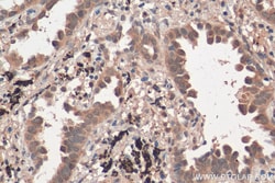 NCOA3 Rabbit Polyclonal Antibody, Proteintech Unconjugated; 150 &mu;L:Antibodies,