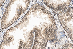 NCOR2 Rabbit Polyclonal Antibody, Proteintech Unconjugated; 20 &mu;L:Antibodies,