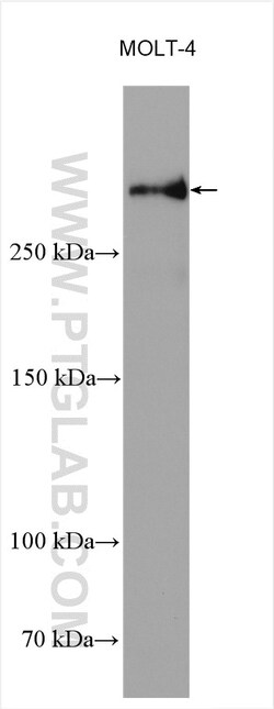 NCOR2 Rabbit Polyclonal Antibody, Proteintech Unconjugated; 20 &mu;L:Antibodies,