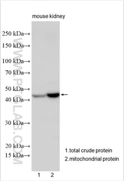 ND4 Rabbit Polyclonal Antibody, Proteintech Unconjugated; 20 &mu;L:Antibodies,