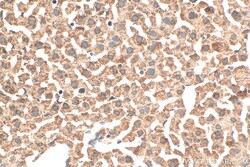 NDUFA9 Rabbit Polyclonal Antibody, Proteintech:Antibodies:Primary Antibodies