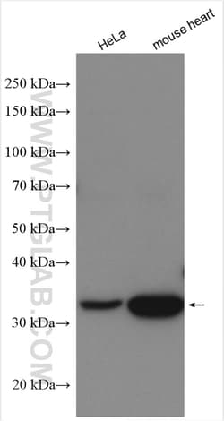 NDUFA9 Rabbit Polyclonal Antibody, Proteintech:Antibodies:Primary Antibodies