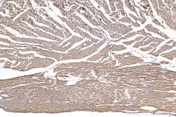NDUFB7 Mouse Monoclonal Antibody, Proteintech Unconjugated; 20 &mu;L:Antibodies,