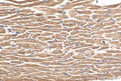 NDUFB7 Mouse Monoclonal Antibody, Proteintech Unconjugated; 20 &mu;L:Antibodies,