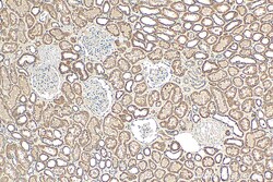 NDUFB8 Mouse Monoclonal Antibody, Proteintech Unconjugated; 150 &mu;L:Antibodies,