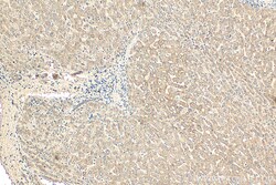 NDUFB8 Mouse Monoclonal Antibody, Proteintech Unconjugated; 150 &mu;L:Antibodies,