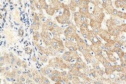 NDUFB8 Mouse Monoclonal Antibody, Proteintech Unconjugated; 150 &mu;L:Antibodies,