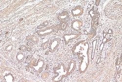 NDUFS6 Mouse Monoclonal Antibody, Proteintech Unconjugated; 150 &mu;L:Antibodies,