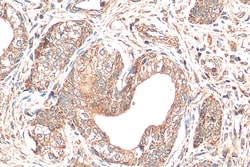 NDUFS6 Mouse Monoclonal Antibody, Proteintech Unconjugated; 150 &mu;L:Antibodies,