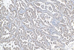 NDUFV1 Mouse Monoclonal Antibody, Proteintech Unconjugated; 150 &mu;L:Antibodies,