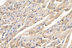 NDUFV2 Mouse Monoclonal Antibody, Proteintech 150 &mu;L | Buy Online | Proteintech | Fisher Scientific