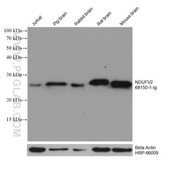 NDUFV2 Mouse Monoclonal Antibody, Proteintech 150 &mu;L | Buy Online | Proteintech | Fisher Scientific
