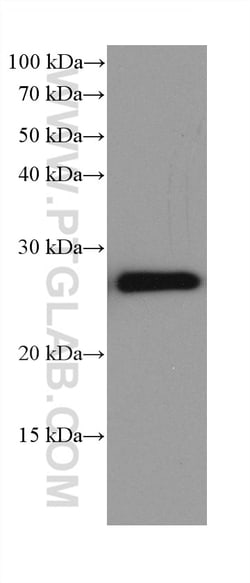 NDUFV2 Mouse Monoclonal Antibody, Proteintech 150 &mu;L | Buy Online | Proteintech | Fisher Scientific