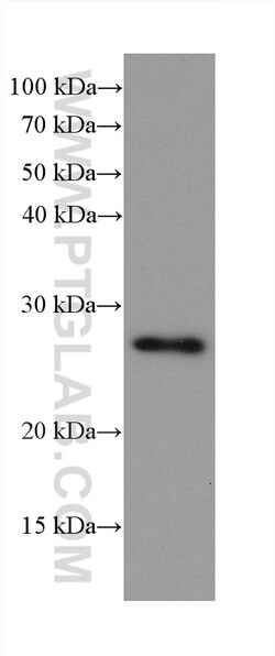 NDUFV2 Mouse Monoclonal Antibody, Proteintech 150 &mu;L | Buy Online | Proteintech | Fisher Scientific