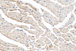 NEBL Rabbit Polyclonal Antibody, Proteintech 20 &mu;L | Buy Online | Proteintech | Fisher Scientific