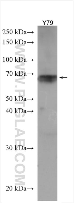 NET1 Rabbit Polyclonal Antibody, Proteintech Unconjugated; 20 &mu;L:Antibodies,