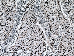 NF45 Mouse Monoclonal Antibody, Proteintech:Antibodies:Primary Antibodies