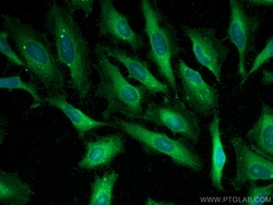 NHE1 Rabbit Polyclonal Antibody, Proteintech Unconjugated; 20 &mu;L:Antibodies,