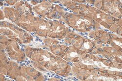 NHE1 Rabbit Polyclonal Antibody, Proteintech Unconjugated; 20 &mu;L:Antibodies,