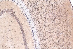 NHLRC2 Rabbit Polyclonal Antibody, Proteintech Unconjugated; 150 &mu;L:Antibodies,