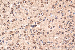 NHLRC2 Rabbit Polyclonal Antibody, Proteintech Unconjugated; 150 &mu;L:Antibodies,