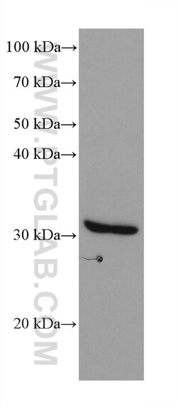 NIT2 Mouse Monoclonal Antibody, Proteintech Unconjugated; 150 &mu;L:Antibodies,