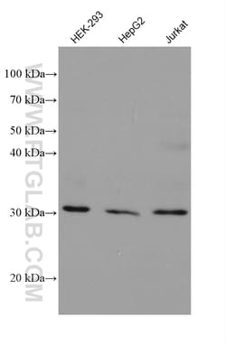 NIT2 Mouse Monoclonal Antibody, Proteintech Unconjugated; 150 &mu;L:Antibodies,