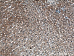 NKPD1 Rabbit Polyclonal Antibody, Proteintech 150 &mu;L | Buy Online | Proteintech | Fisher Scientific