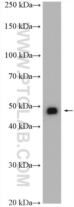 NKX6-1 Rabbit Polyclonal Antibody, Proteintech 20 &mu;L | Buy Online | Proteintech | Fisher Scientific