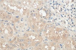 NLRP3 Mouse anti-Human, Mouse, Clone: 3H1A7, Proteintech 150 &mu;L; Unconjugated:Anticuerpos