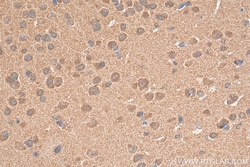NMDAR2A/GRIN2A Rabbit Polyclonal Antibody, Proteintech Unconjugated; 20