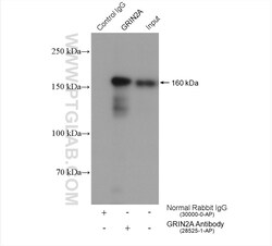 NMDAR2A/GRIN2A Rabbit Polyclonal Antibody, Proteintech Unconjugated; 20