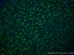NMDAR2A/GRIN2A Rabbit Polyclonal Antibody, Proteintech:Antibodies:Primary