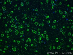 NMDAR2A/GRIN2A Rabbit Polyclonal Antibody, Proteintech:Antibodies:Primary