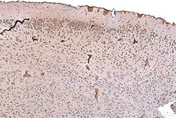 NMDAR2A/GRIN2A Rabbit Polyclonal Antibody, Proteintech:Antibodies:Primary