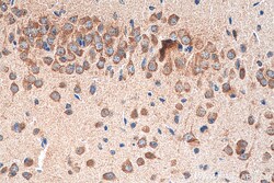 NMDAR2A/GRIN2A Rabbit Polyclonal Antibody, Proteintech:Antibodies:Primary