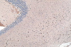 NMDAR2A/GRIN2A Rabbit Polyclonal Antibody, Proteintech:Antibodies:Primary