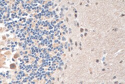 NMDAR2A/GRIN2A Rabbit Polyclonal Antibody, Proteintech:Antibodies:Primary