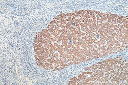 NMT1 Mouse Monoclonal Antibody, Proteintech:Antibodies:Primary Antibodies