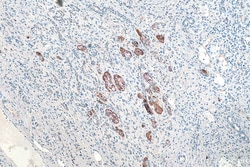 NMT1 Mouse Monoclonal Antibody, Proteintech:Antibodies:Primary Antibodies