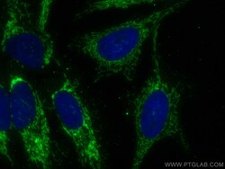NNT Mouse Monoclonal Antibody, Proteintech Unconjugated; 20 &mu;L:Antibodies,