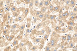 NNT Mouse Monoclonal Antibody, Proteintech Unconjugated; 20 &mu;L:Antibodies,