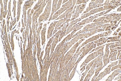 NNT Mouse Monoclonal Antibody, Proteintech Unconjugated; 20 &mu;L:Antibodies,
