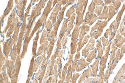 NNT Mouse Monoclonal Antibody, Proteintech Unconjugated; 20 &mu;L:Antibodies,